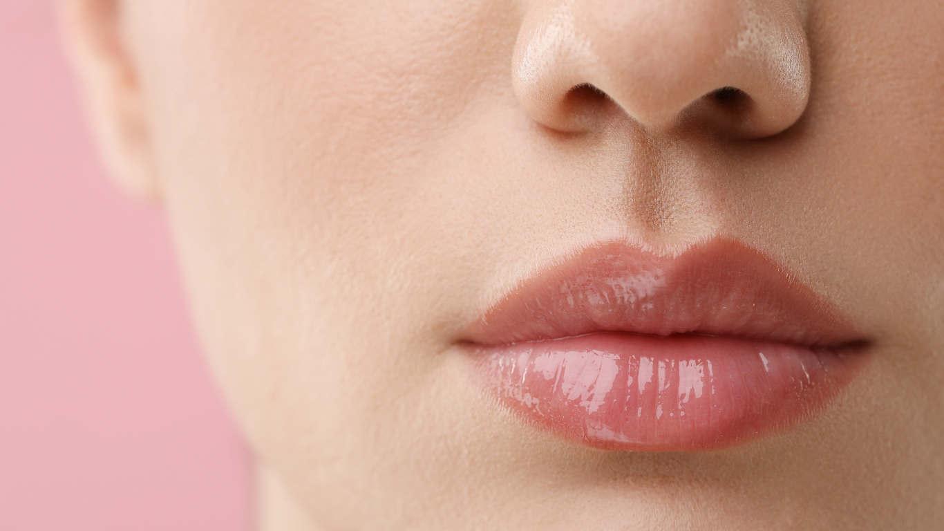 Resultado natural de preenchimento labial